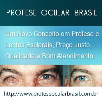 Prótese Ocular BRASIL RJ - Atendemos todo o RJ - Trabalhamos com próteses de qualidade