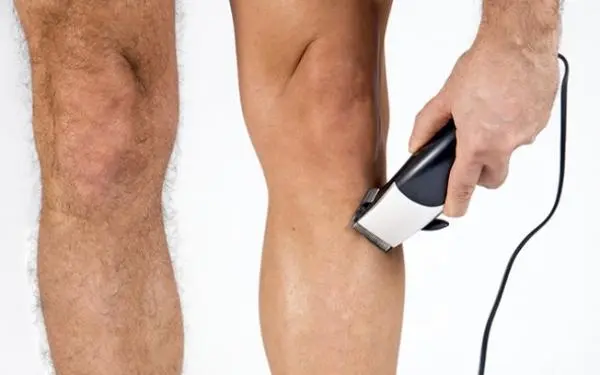 Depilação masculina Taquara