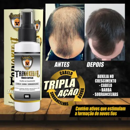Tônico capilar, livre de calvíce cabelos mais volumosos