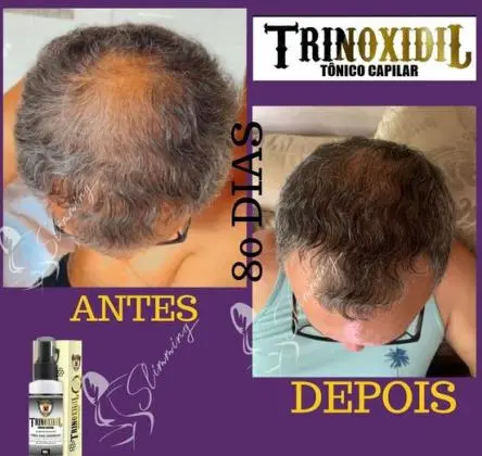 Trinoxidiu Spartan