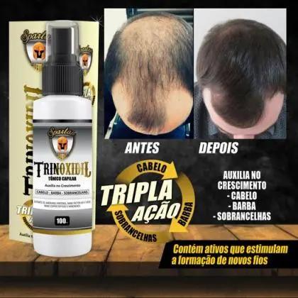 Trinoxidiu Spartan