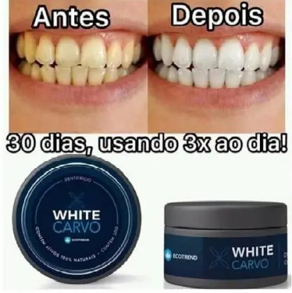 clareador dental