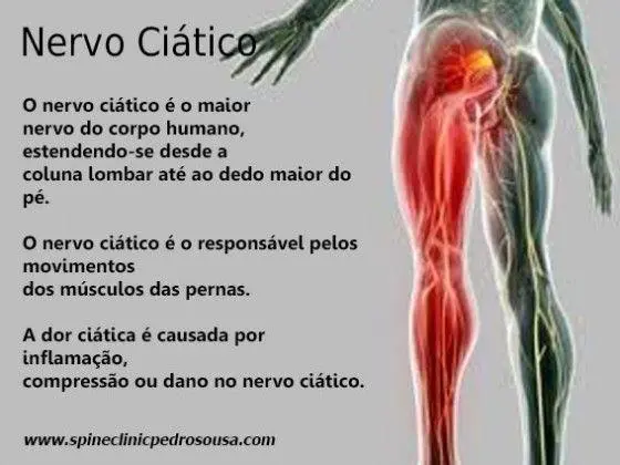 Dor no nervo ciático - Massagem - Centro - São José SC