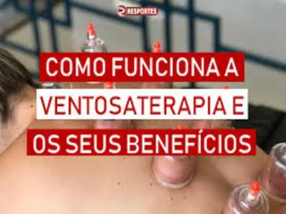Massagem com ventosas - Vico Massagista - São José (SC)