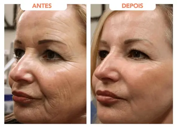 Regenere Drops