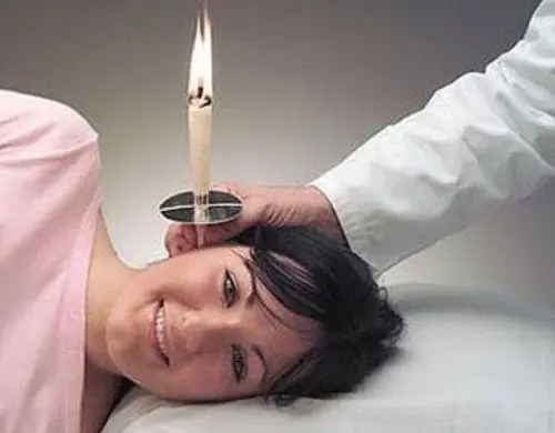 Cone chines para limpeza dos ouvidos com frete gratis