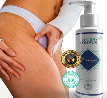Creme AntiEstrias Removedor Estrias