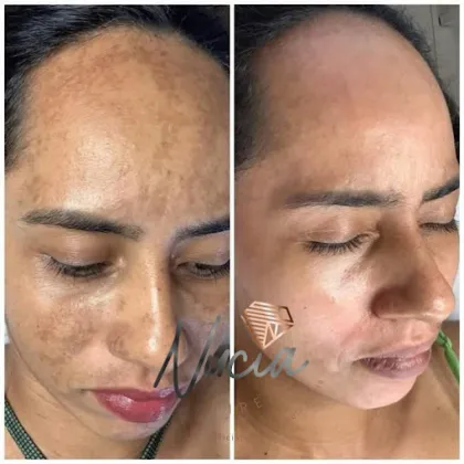 CENTRO DE ESTÉTICA LAPIDATE - NUCIA PIRES