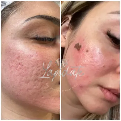 CENTRO DE ESTÉTICA LAPIDATE - NUCIA PIRES