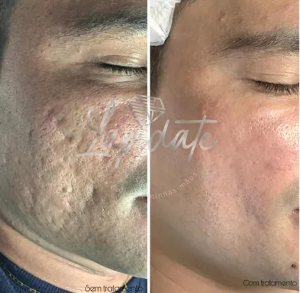 CENTRO DE ESTÉTICA LAPIDATE - NUCIA PIRES