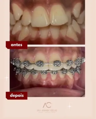 ODONTOFACE ODONTOLOGIA ESPECIALIZADA