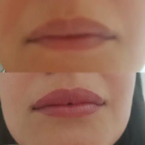 Micropigamentacao labial