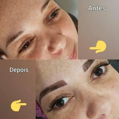 Micropigamentacao com anestesico