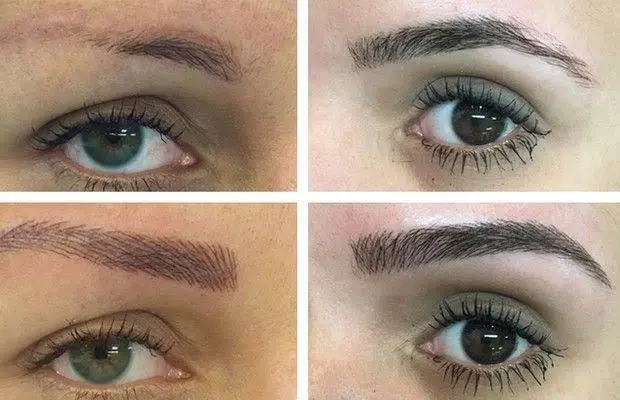 Microbleing e alongamento de unha