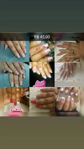 Alogamento em gel