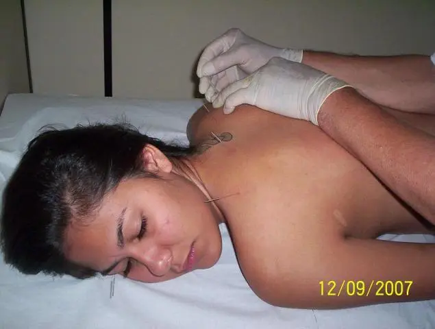 ACUPUNTURA, SHIATSU & TERAPIAS