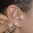 SHIATSU E ACUPUNTURA - TERAPIAS ALTERNATIVAS