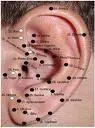 ACUPUNTURA CURA DEPRESSÃO